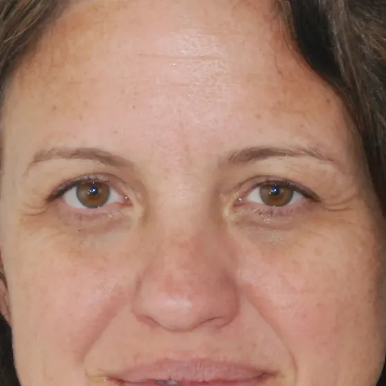 files/Tamara_redensityII_before.png